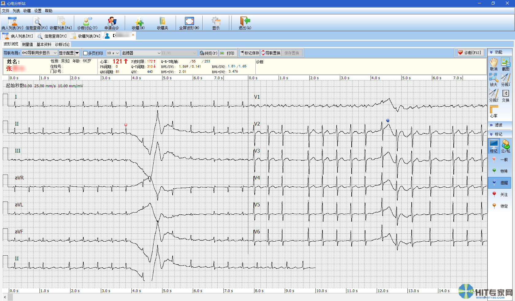 心电信息系统进入数据挖掘阶段